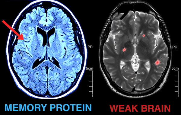 Brain scan comparison